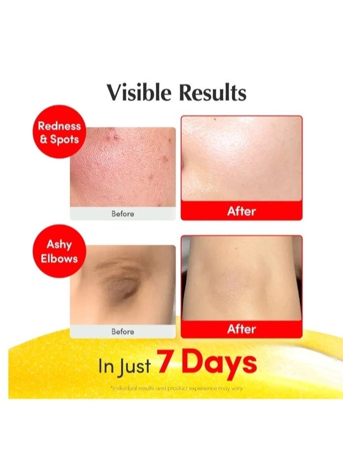 eqqualberry Vitamin Illuminating Serum – Brightening Vitamin C Serum with Niacinamide | Strengthens skin barrier | Hydrates using Ceramide and Hyaluronic Acid, 1.01oz / 30ml - Image 2